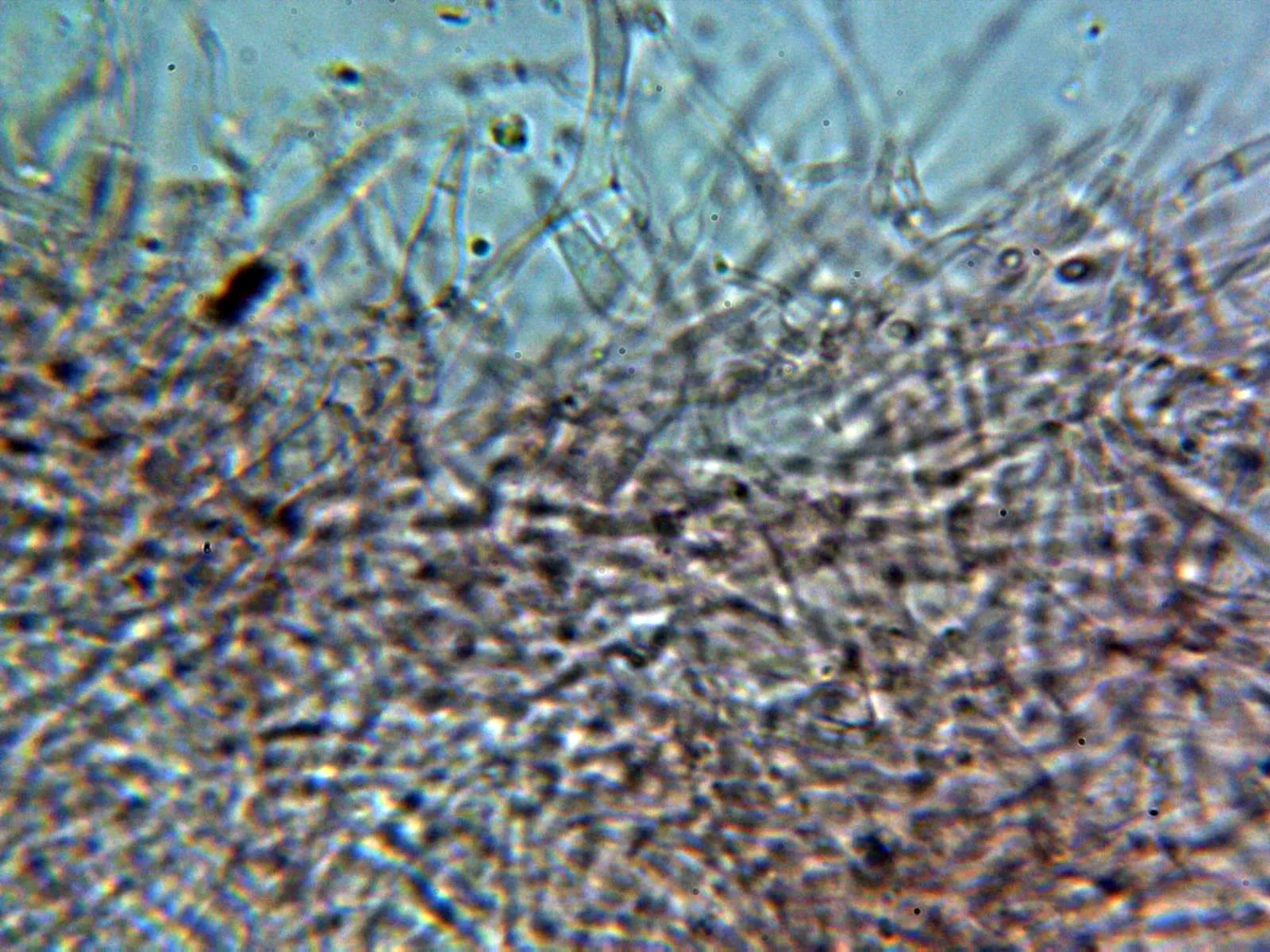 Microscopía de Thecotheus pelletieri - 14 - Contexto 2